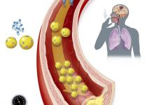 肥胖的七大并发症是什么?健康减脂的要点,针对肥胖的营养食疗辅助方案-高血脂高血压健康有方网