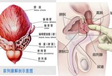川公英|前列腺问题和男士功能障碍康复自然疗法-高血脂高血压健康有方网