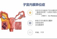 川公英|子宫内膜异位症能治愈吗？纯自然疗法康复案例四-高血脂高血压健康有方网